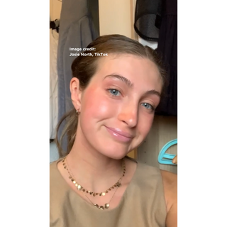 Topical Steroid Withdrawal (TSW) Josie's Dead Sea Facial starter kit- Josie after Dead Sea Salt treatment 