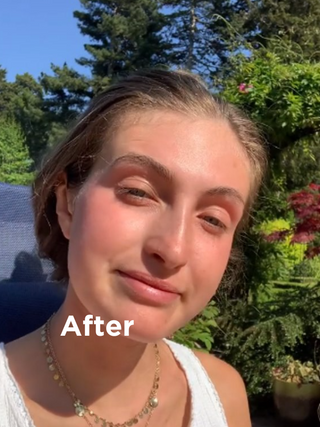 Face shot after using Eczema + Psoriasis Solutions