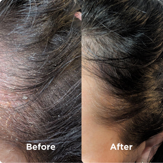 Hair before and after 3 Seaweed Scalp Mud