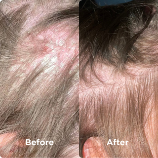 Before and After 3 Seaweed Scalp Mud