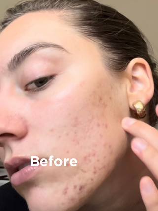 Skin before Sea Magik's 3-Step Face Skin Health