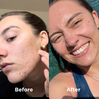 Before and After Sea Magik skincare