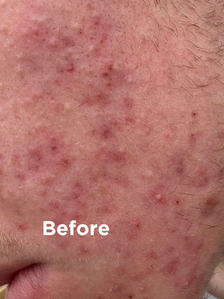 Before using Sea Magik Black Mud Soap