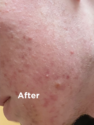 After using Sea Magik Black Mud Soap