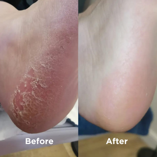 Before and After Sea Magik Natural Skin Softener 